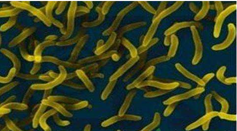 微生物菌劑好？好在哪里您知道嗎？